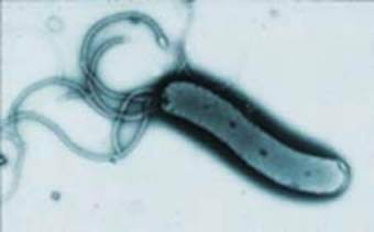 Helicobacter Pylori, ���� � ����� shef.ac.uk