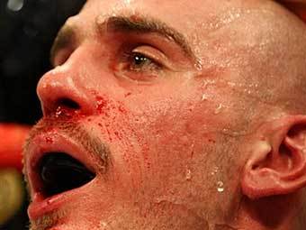 ����� ������. ���� AFP