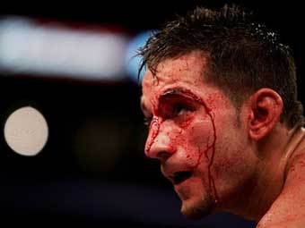 ������ ���� �� ����� ���-��� "����������". ���� AFP