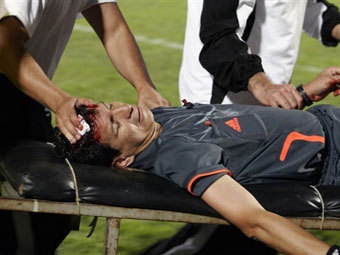 ����� ���������. ���� AFP