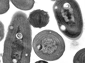  -   Synechococcus  .   Daniel Vaulot   wikipedia.org